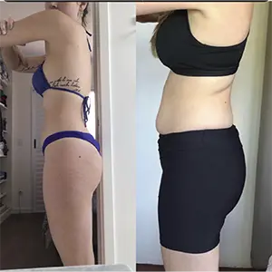 Resultado Lymphoderm