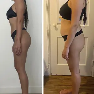 Resultado Lymphoderm