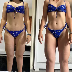 Resultado Lymphoderm