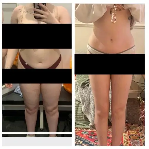 Resultado Lymphoderm